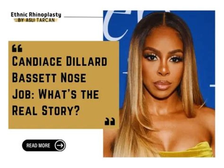 Did Candiace Dillard Get a Nose Job? The 'RHOP' Star Has Denied It