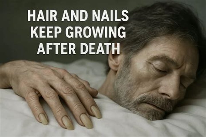 Does A Person's Hair And Fingernails Really Keep Growing After Death? ·