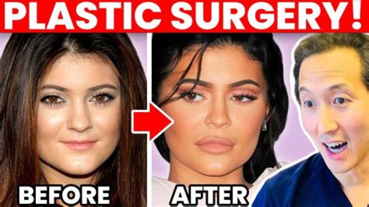KYLIE JENNER PLASTIC SURGERY RUMORS ADDRESSED-Video