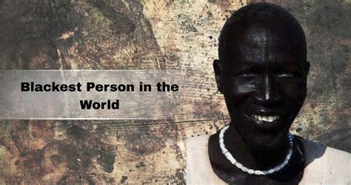 Who is the Blackest Person in the World? The Truth Behind the Viral Photos